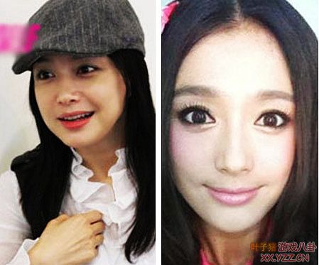 娱乐圈女明星大饼脸惊变锥子